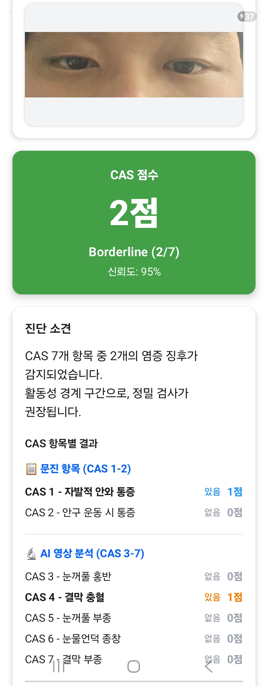 진단 결과